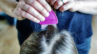 Gestul revoltător al unei mame! Femeia, vegană, refuză să o scape pe fiica sa de păduchi. „Eu nu omor ființe vii”