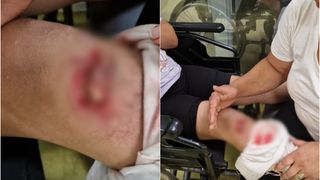La Spitalul din Suceava, un copil care avea o rană deschisă, nu a fost tratat timp de c&acirc;teva ore