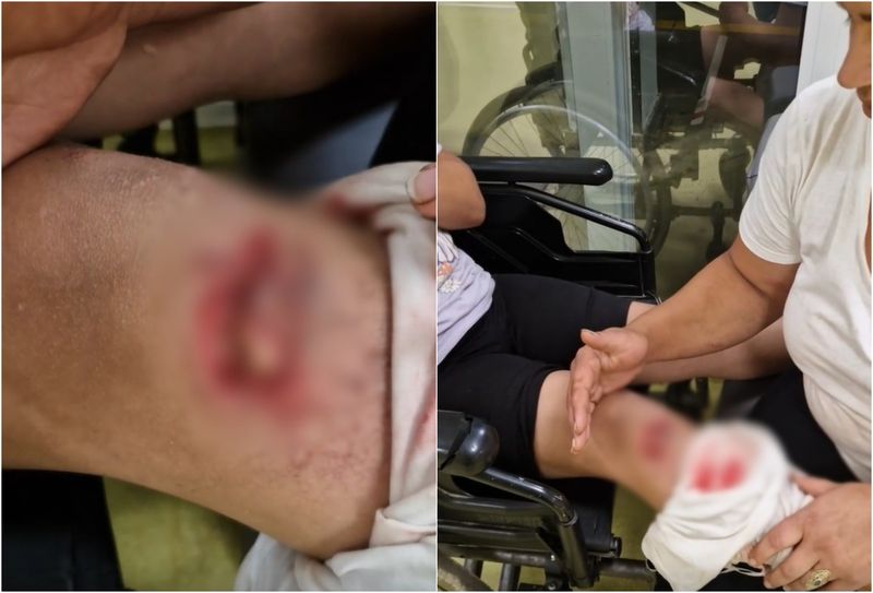 La Spitalul din Suceava, un copil care avea o rană deschisă, nu a fost tratat timp de câteva ore