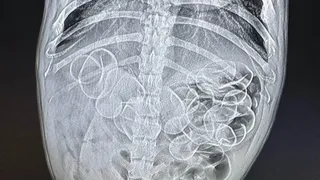 Acest cățel a ajuns &icirc;n stare gravă la veterinar după ce a &icirc;nghițit mai multe rățuște de cauciuc. A fost operat de urgență. Care este starea patrupedului acum