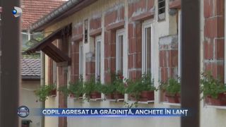 VIDEO - Copil agresat la grădiniță, anchete &icirc;n lanț. A fost mușcat de față de un alt coleg