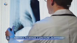 VIDEO - Cancerul pulomar, o afecțiune „silențioasă”. 1 din 15 bărbați din România este diagnosticat cu cancer la plămâni