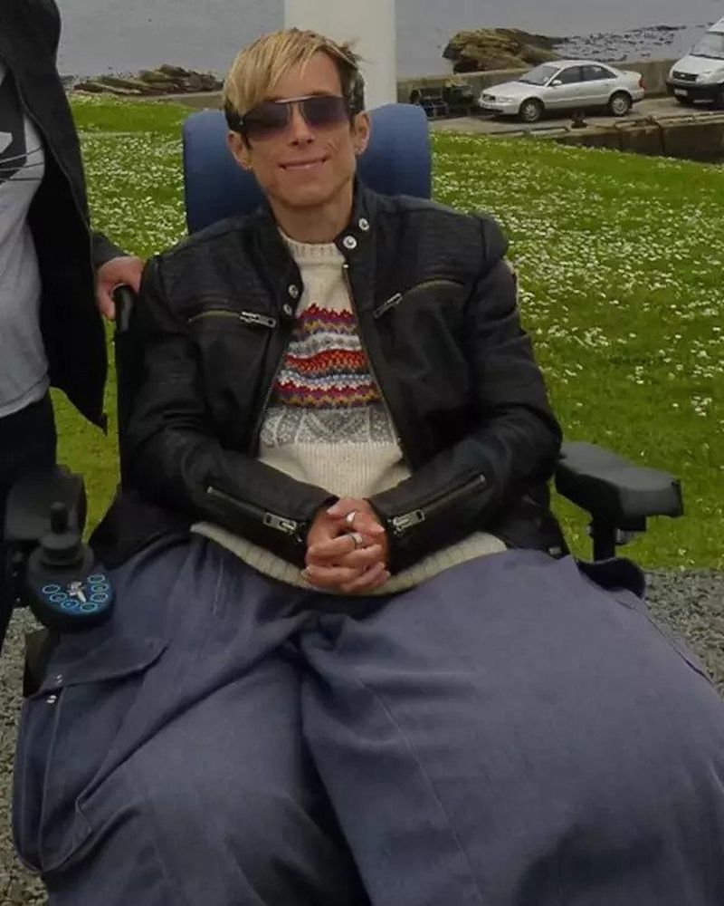 Medicii au decis să-i amputeze un picior femeii care s-a născut cu picioare anormal de mari doar pentru ca acesta să „crească înapoi”: „Uită-te la dimensiunea acestor picioare!”