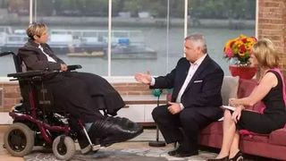 Medicii au decis să-i amputeze un picior femeii care s-a născut cu picioare anormal de mari doar pentru ca acesta să „crească înapoi”: „Uită-te la dimensiunea acestor picioare!”