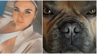 Tânără de 24 de ani, atacată de câine în momentul în care a vrut să-l mângâie: ”Eram în casă de doar două minute”