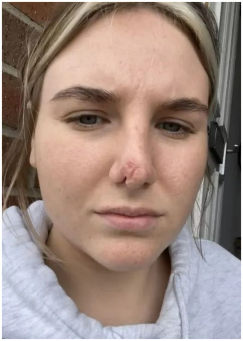 Rebecca Scobie- femeia mușcată de câine