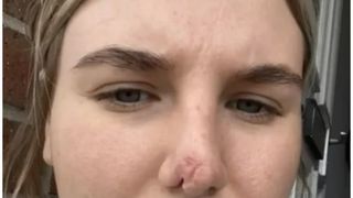 Rebecca Scobie- femeia mușcată de câine