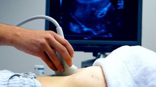 "M-au obligat să privesc operația prin cezariană și am dezvoltat o boală psihotică". Un bărbat cere despăgubiri uriașe de la spitalul unde a născut soția sa