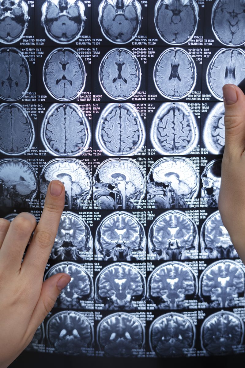 Experimentele pe creierul uman au fost aprobate. 