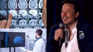 Experimentele pe creierul uman au fost aprobate. Elon Musk poate începe studiul pe oameni