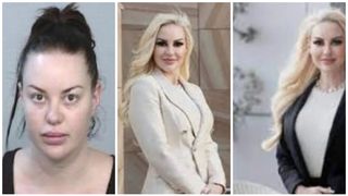 "Milionara fără chip", greu de arestat. O femeie de afaceri a scăpat de urmărirea poliției după mai multe operații estetice