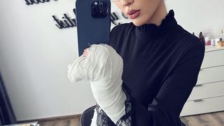 Dana Roba are o cicatrice pe frunte, altele &icirc;n cap, iar potrivit declarațiilor sale, nu va mai avea niciodată gust și miros.