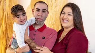 El este cel mai păros bebeluș. La doar un an, micuțul are mai mult păr pe corp decât majoritatea bărbaților adulți. „Arată de parcă are 35 de ani”