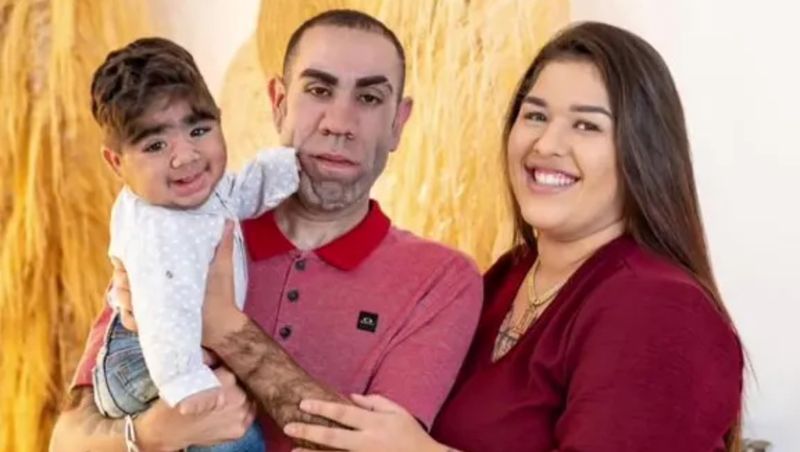 El este cel mai păros bebeluș. La doar un an, micuțul are mai mult păr pe corp decât majoritatea bărbaților adulți. „Arată de parcă are 35 de ani”