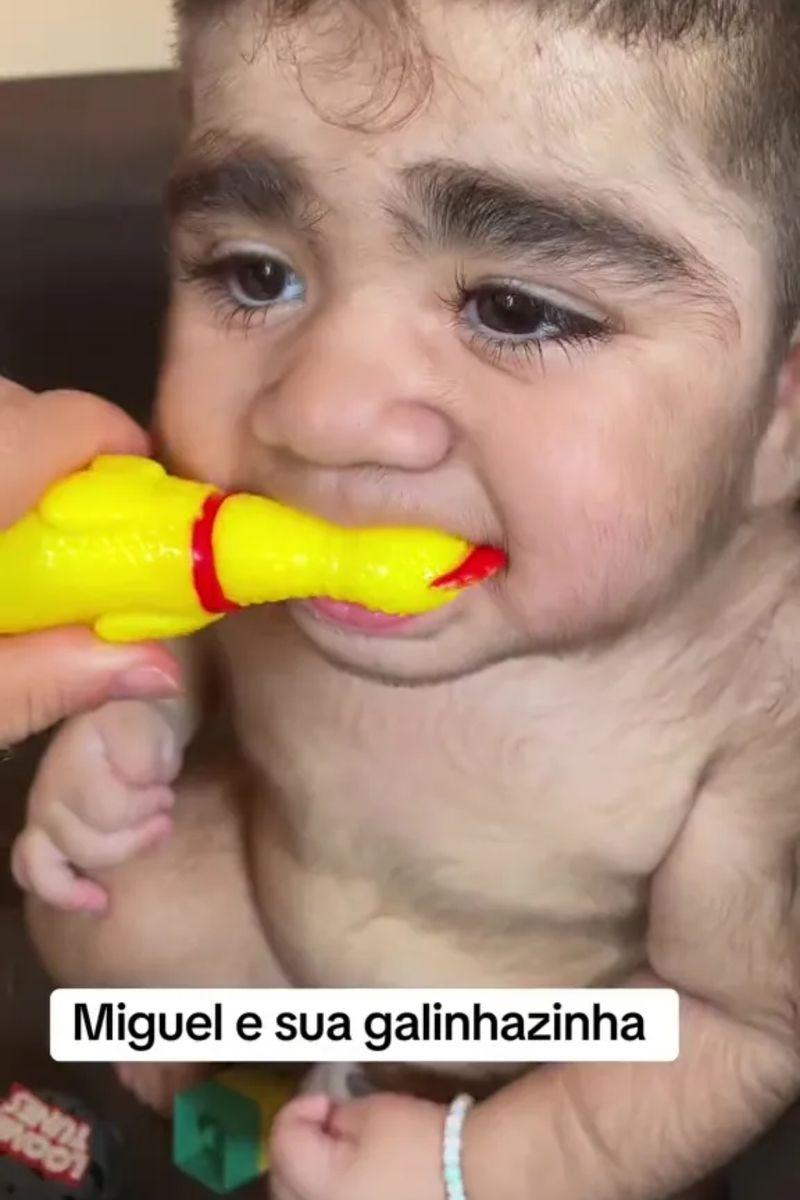 El este cel mai păros bebeluș. La doar un an, micuțul are mai mult păr pe corp decât majoritatea bărbaților adulți. „Arată de parcă are 35 de ani”