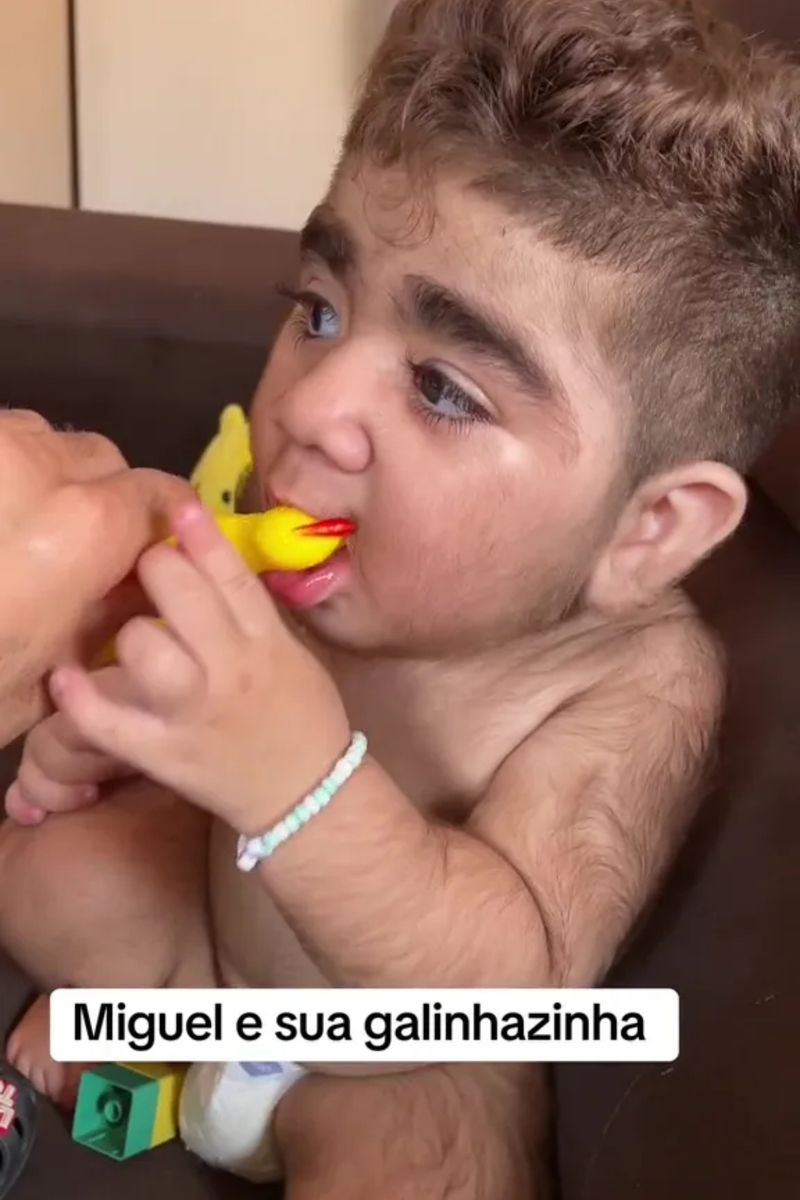 El este cel mai păros bebeluș. La doar un an, micuțul are mai mult păr pe corp decât majoritatea bărbaților adulți. „Arată de parcă are 35 de ani”