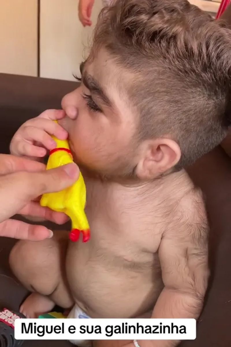 El este cel mai păros bebeluș. La doar un an, micuțul are mai mult păr pe corp decât majoritatea bărbaților adulți. „Arată de parcă are 35 de ani”