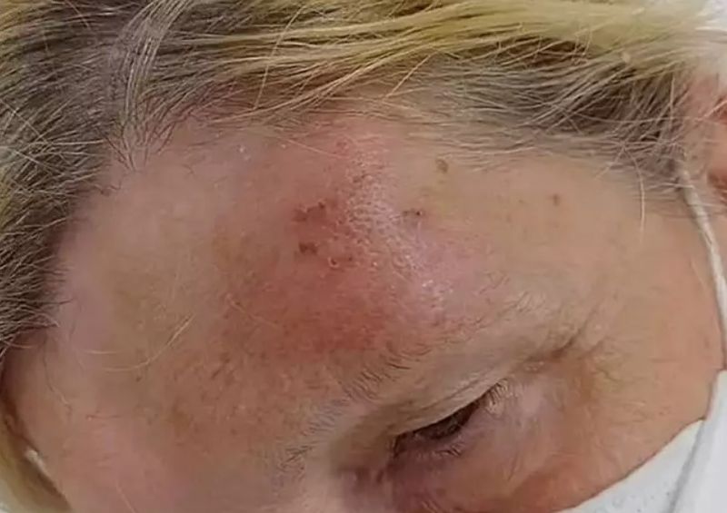 O femeie mușcată de lilieci se teme că ar putea muri din cauza unui virus mortal: „Nu am crezut că acest lucru se poate întâmpla în viața reală”
