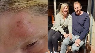 O femeie mușcată de lilieci se teme că ar putea muri din cauza unui virus mortal: „Nu am crezut că acest lucru se poate întâmpla în viața reală”