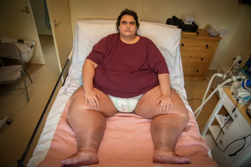 E este cel mai greu bărbat din UK. Jason cântărește aproape 300 de kg. „Adorm plângând în fiecare noapte”