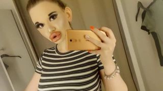 Femeia cu cele mai mari buze din lume vrea acum cei mai mari obraji: &bdquo;Voi continua cu mai multe injecții&rdquo;