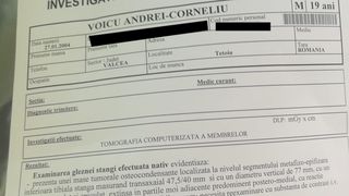 La două săptăm&acirc;ni după BAC, a aflat că are cancer! La 19 ani, Andrei visa să-și ajute sora bolnavă de autism. Rămas fără un picior, speranța lui au rămas oamenii. Poveste cumplită de viață