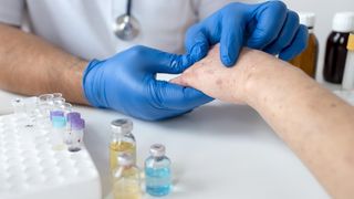 FOTO- A descoperit remediul pentru cancerul de piele la doar 14 ani. Produsul care va revoluționa industria farmaceutică