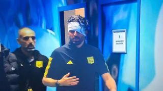 &Icirc;n urma atacului, antrenorul echipei Lyon, Fabio Grosso a fost rănit la cap.