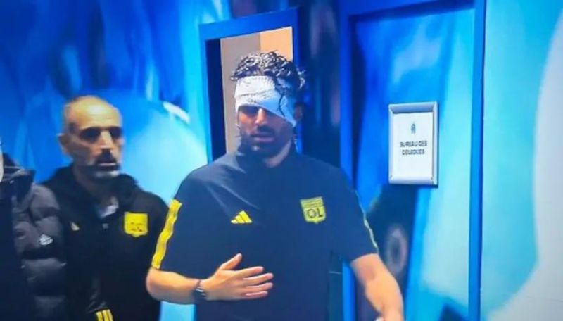 În urma atacului, antrenorul echipei Lyon, Fabio Grosso a fost rănit la cap.