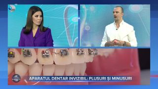 VIDEO - Aparatul dentar invizibil: plusuri și minusuri. „Aparatul invizibil, care acoperă dintele în totalitate, acționează pe toată suprafața”