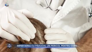 Infestarea cu păduchi, un pericol pentru copii. &bdquo;Pediculoza și anginele ocupă primul loc din bolile depistate&rdquo;