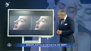 VIDEO- Rinoplastia și deviația de sept. Ce presupune această intervenție și cât de complicată este?