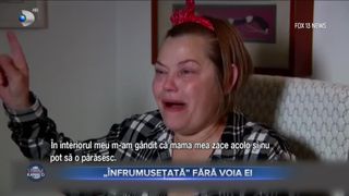 VIDEO - &bdquo;&Icirc;nfrumusețată&rdquo; fără voia ei. O pensionară a mers la medic pentru &icirc;ndepărtarea excesului de piele, &icirc;nsă s-a trezit cu implanturi și lifting