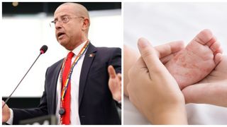 Epidemie de rujeolă la nivel național! Cum putem recunoaște rujeola și ce presupune tratamentul în cazul acestei boli virale acute