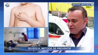 VIDEO- Rujeola, virus frecvent întâlnit în România. Cum identificăm primele simptome?