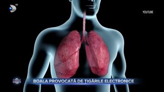 VIDEO- Boala provocată de țigările electronice. Afecțiunea Evali, din ce &icirc;n mai &icirc;nt&acirc;nită printre adolescenți