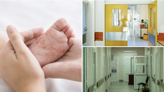 Crește numărul cazurilor de rujeolă