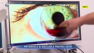 VIDEO - Petardele și riscurile pentru ochi. Avertizările medicilor