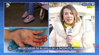 VIDEO- Mii de cazuri de rujeolă de la &icirc;nceputul anului. Din păcate, au fost raportate și decese cauzate de acest virus