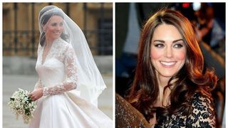Kate Middleton operată