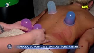 VIDEO- Masajul cu ventuze și bambus, vedeta iernii. Doamnele profită din plin de sezonul rece ca să-și pregătească trupurile pentru vară