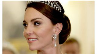 Prințesa Kate recuperare operație