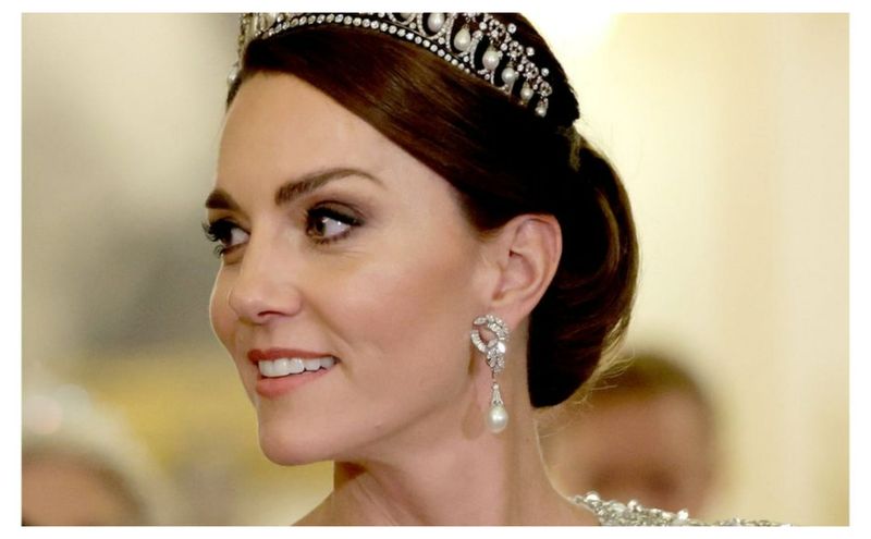 Prințesa Kate recuperare operație