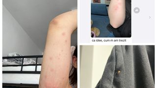 Invazie ploșnițe cămin București