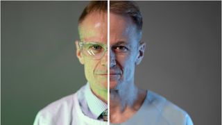 Medicul care a vindecat mii de pacienți cu cancer are o tumoare pe creier care îl ucide rapid. "Nu mă las"