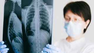 Ce se &icirc;nt&acirc;mplă &icirc;n corpul tău după 7 zile de post negru