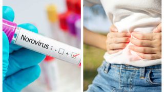 Norovirus Timișoara