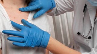 Alertă scarlatină Rom&acirc;nia