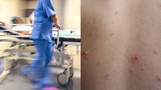 Rujeola face din nou victime! Un bărbat de 41 de ani din Sibiu a încetat din viață, după ce s-ar fi tratat acasă