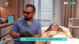 VIDEO - Tratament &icirc;mpotriva vergeturilor. Ce presupune noua procedură?